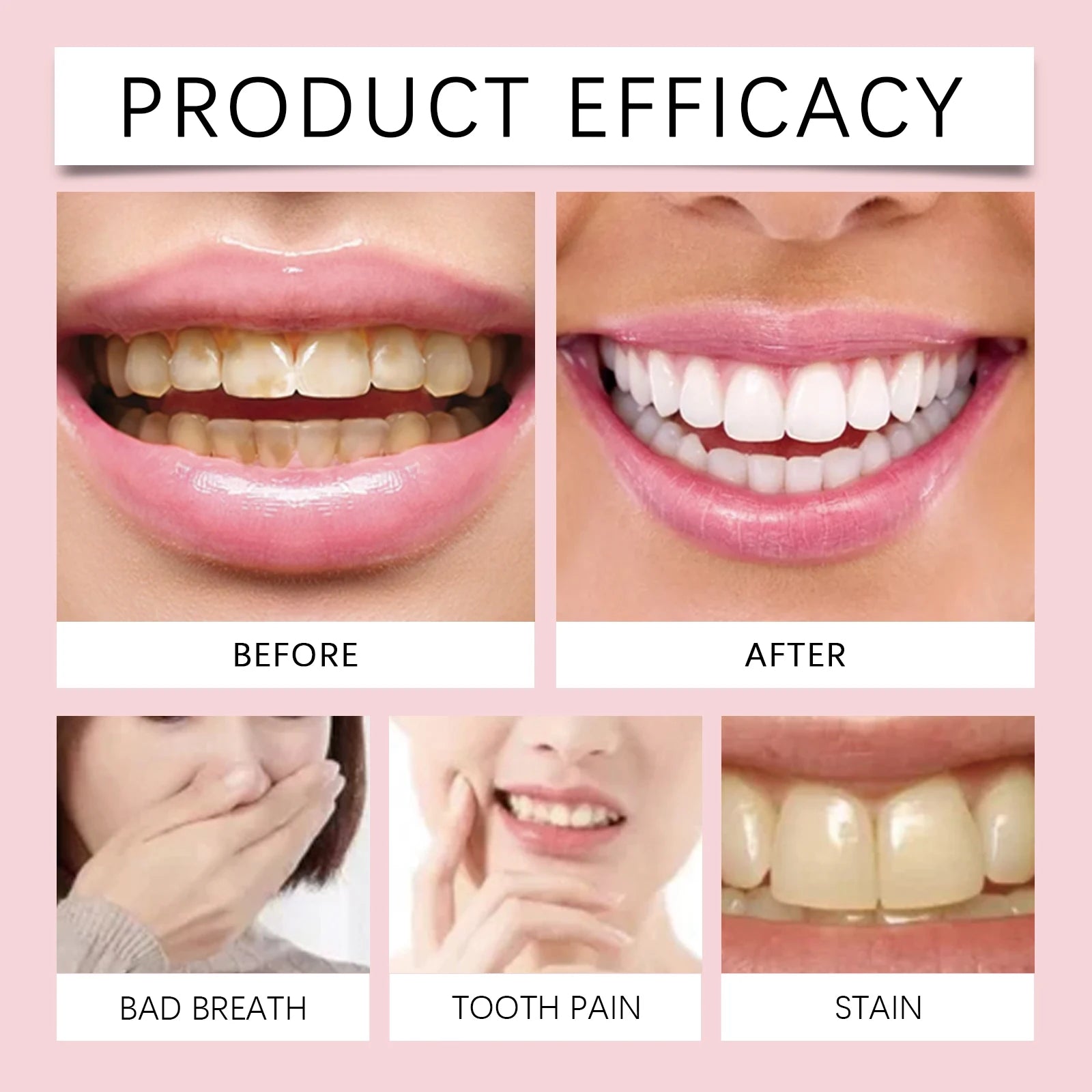 Sp 6 Probiotic Toothpaste Dental Stone Removal Improve Tooth Yellow Remove Stains Prevent Periodontitis Teeth Whitening Products