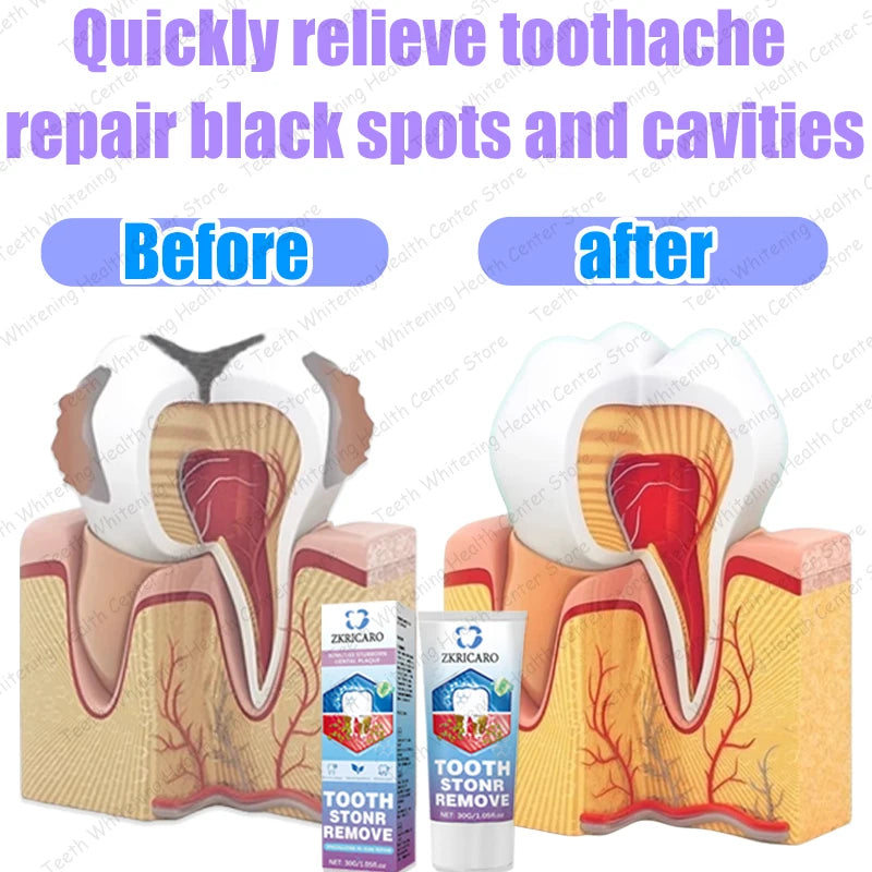 Contains probiotics to repair tooth decay and clean teeth