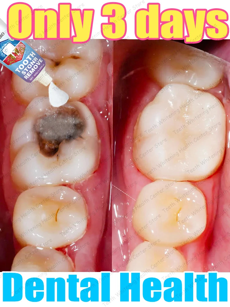 Contains probiotics to repair tooth decay and clean teeth