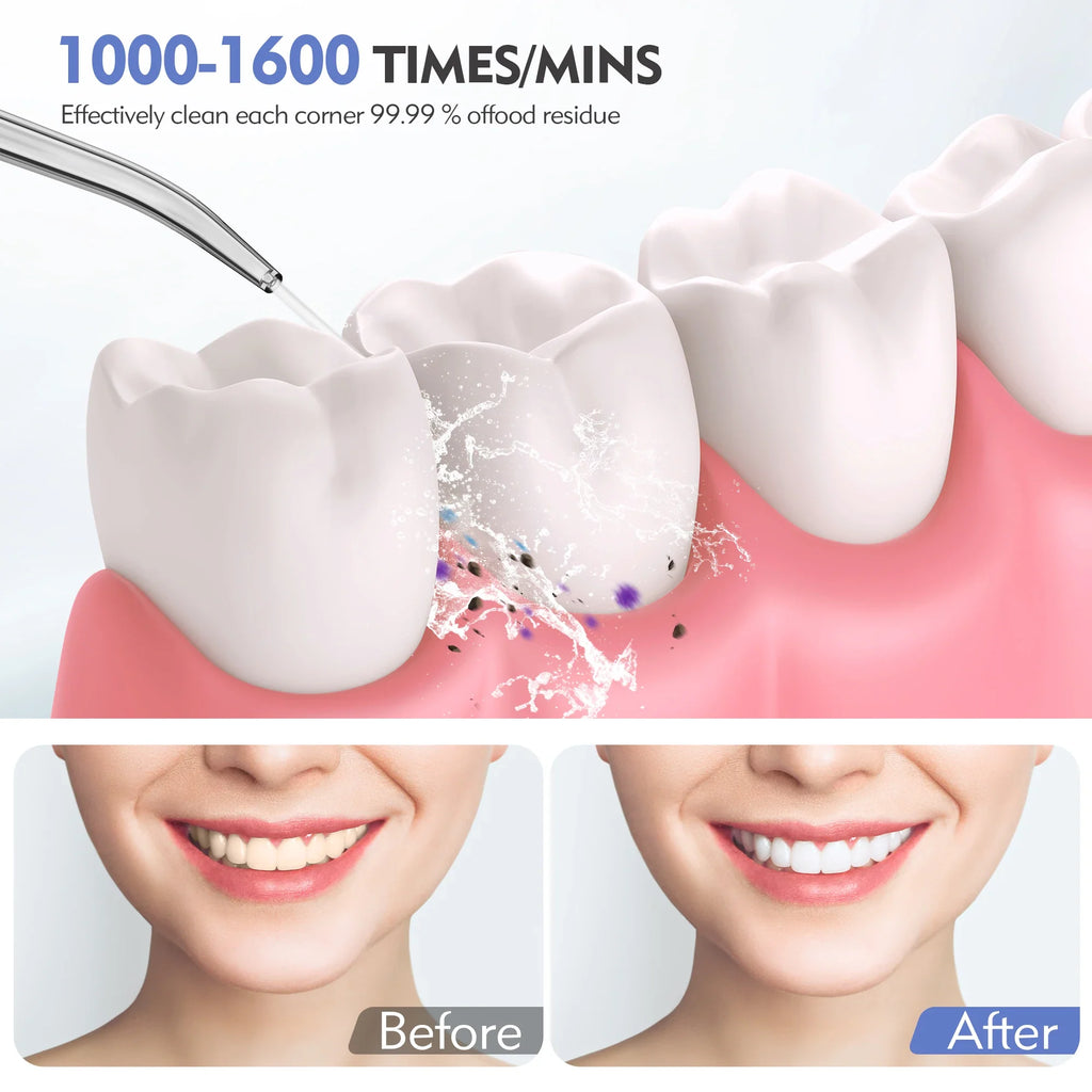 Water Flosser