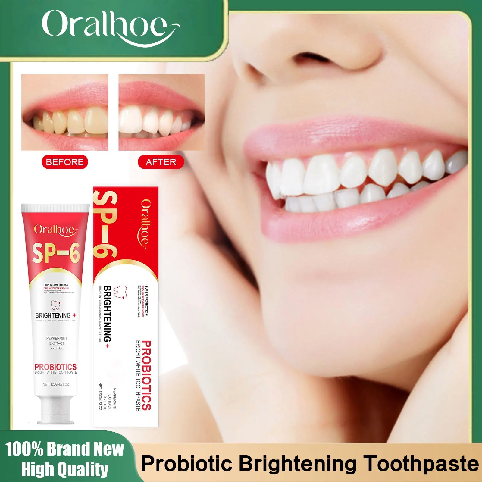 Sp 6 Probiotic Toothpaste Dental Stone Removal Improve Tooth Yellow Remove Stains Prevent Periodontitis Teeth Whitening Products